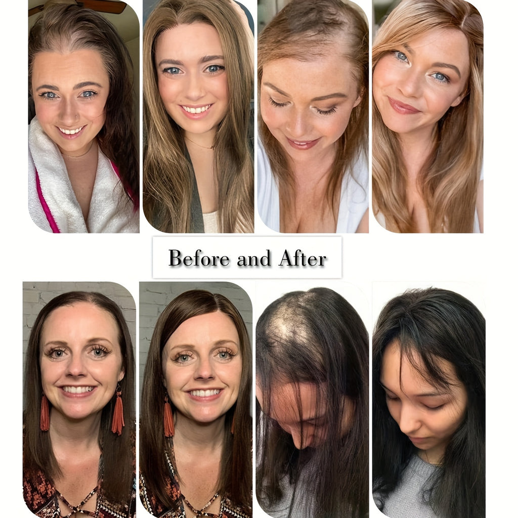 18-Inch Hair Toppers Designed for Women Experiencing Hair Thinning, Featuring a Large 6.5X6.5 Inch Coverage. These Synthetic Hair Toppers Come in Ombre Blonde And Are Perfect for Adding Volume to Thin Hair